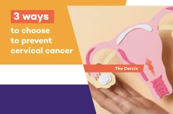 Cervical Cancer